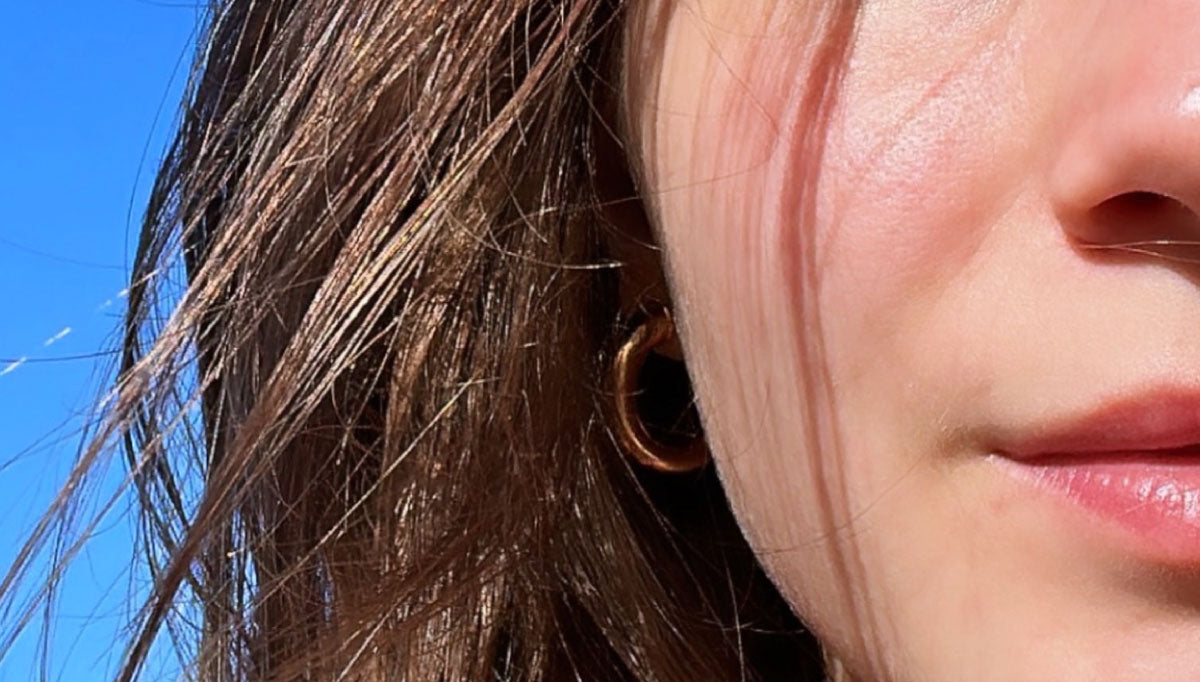 Why your skin reacts in summer (and what it’s trying to tell you)