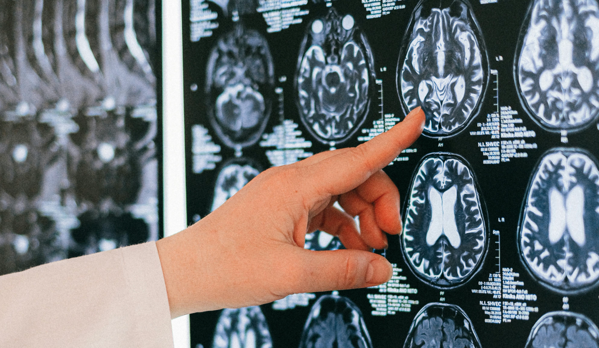 Magnesium & cognitive ageing: why this mineral matters more than we realise