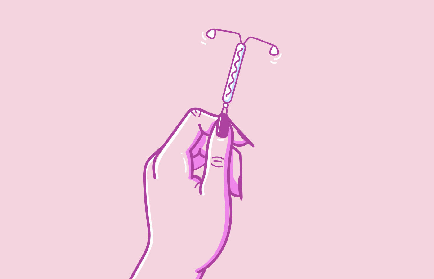 All about the hormonal IUD (Mirena®)